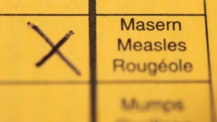 Die Weltgesundheitsorganisation empfiehlt, dass mindestens 95 Prozent der Bevölkerung zwei Masern-Impfdosen erhalten. (Archivbild)
