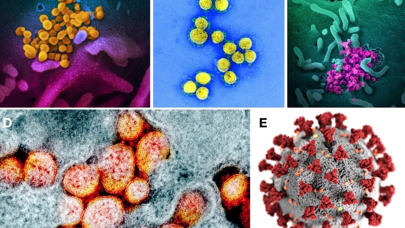 Verschiedene Darstellungen des Coronavirus Sars-CoV-2: Je "schöner" das Bild des Virus, umso harmloser wird der Erreger empfunden, wie aus einer Studie hervorgeht.