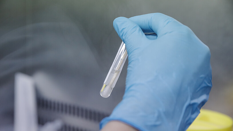 Eine Krankenschwester führt einen PCR-Test zur Erkennung des Affenpockenvirus durch. Die WHO will den Affenpocken einen neuen Namen geben. Es gebe Bestrebungen, Krankheiten nicht mehr nach Tieren oder Regionen zu benennen, um mögliche Stigmatisierungen…
