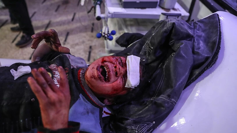 Ein verletztes Kind im Spital von Ost-Ghuta nach einem Angriff von syrischen Regierungstruppen auf die von Rebellen belagerte Stadt.