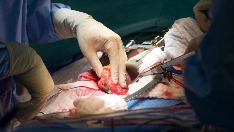Eine Nierentransplantation. 
