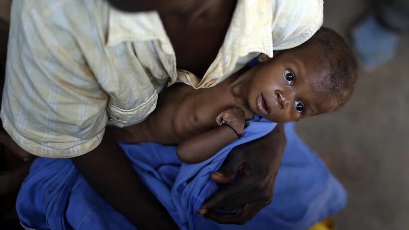 Eine Mutter wartet mit ihrem unterernährten Baby in einer Gesundheitsstation im zentralafrikanischen Bangui - die Hungersituation in der Zentralafrikanischen Republik wird im Welthungerindex als "gravierend" eingestuft. (Archiv)
