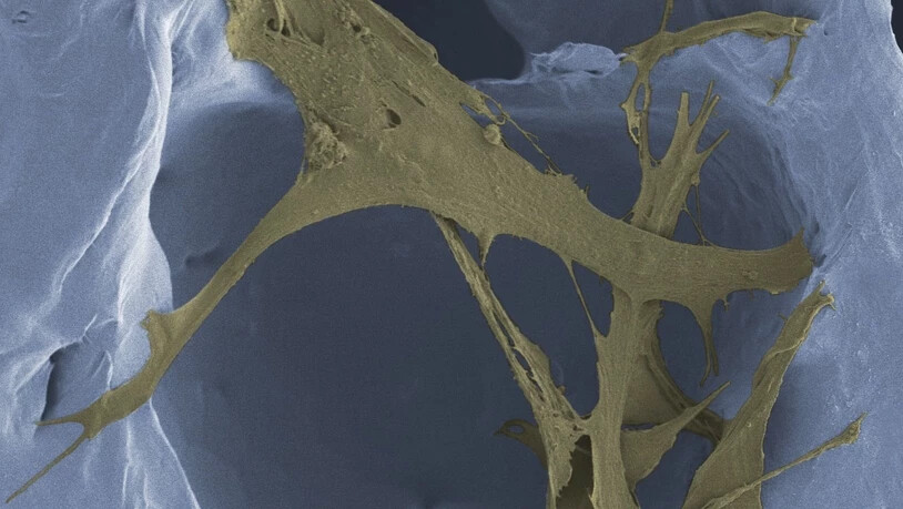 Im Gerüst des Polymerschaums finden Zellen - wie diese Fibroblasten - guten Halt, um neues Hautgewebe aufzubauen. 
(Kolorierte Mikroskopaufnahme, Vergrösserung 1200-fach)