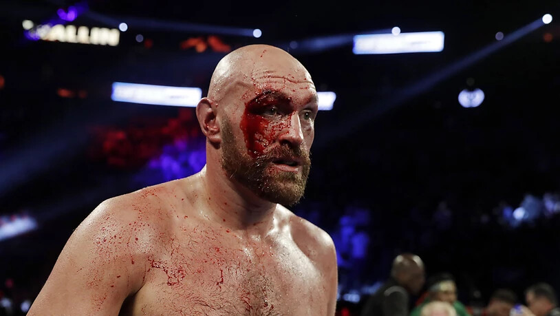 In der 3. Runde zog sich Fury eine tiefe und stark blutende Schnittwunde oberhalb des rechten Auges zu