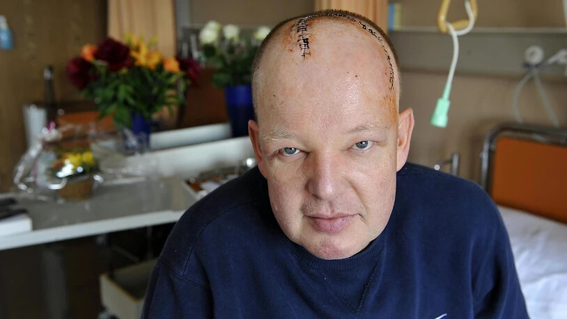 Nach seiner Zeit als Radprofi erlitt Dill-Bundi mehrere Schicksalsschläge. 1999 diagnostizierten die Ärzte bei ihm einen Hirntumor. Mehrere Operationen, eine Chemo- und eine riskante Elektrotherapie später galt er 2010 als geheilt. Doch der IV-Rentner…