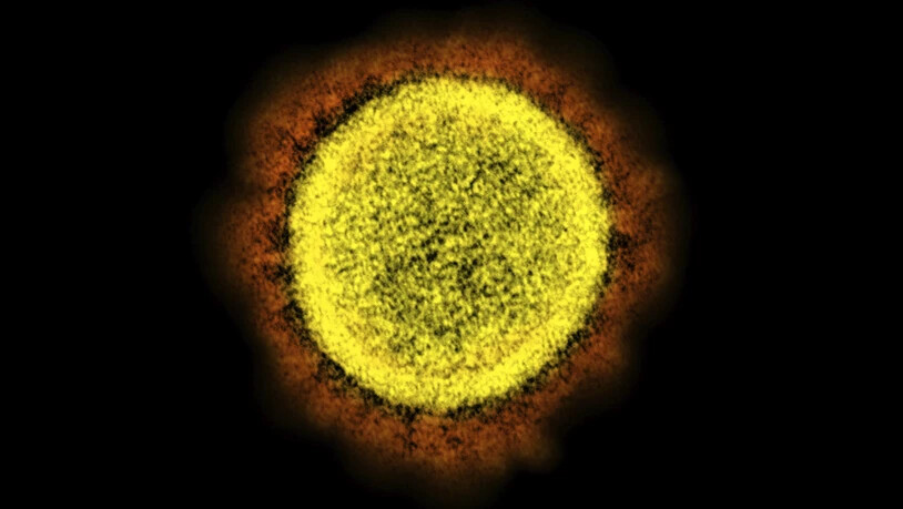 HANDOUT - Die vom National Institute of Allergy and Infectious Diseases zur Verfügung gestellte elektronenmikroskopische Aufnahme aus einem Labor in Fort Detrick zeigt das Covid-19 verursachende Coronavirus SARS-CoV-2, das von einem Patienten isoliert…