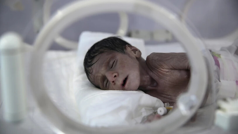 ARCHIV - Ein unterernährtes Neugeborenes liegt in einem Inkubator im internationalen Krankenhaus UniMax. Nach Angaben der Vereinten Nationen stehen im Jemen fast 400 000 Kinder vor dem Hungertod. Rund 20 Millionen Menschen brauchten Hilfe, sagte der UN…
