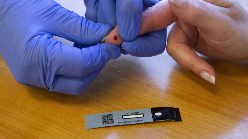 Ausgelagert: Für den Antikörpertest muss ein Arzt Blut abnehmen und die Probe an ein externes Labor schicken.