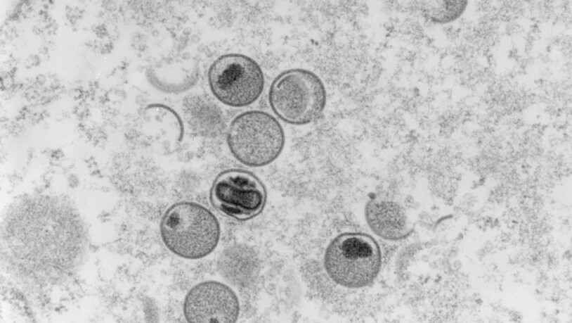 Elektronenmikroskopische Aufnahme von Affenpocken-Viren. In der Schweiz sind bis Montag 416 Fälle von Affenpocken aufgetreten. (Archivbilld)